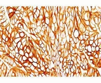 Anti-Cytokeratin 18 Antibody