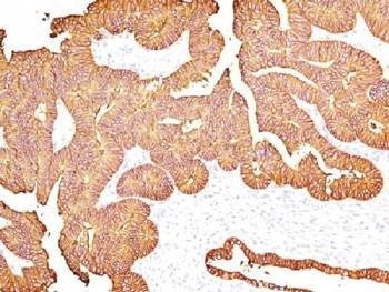 Anti-EpCAM Antibody, Sodium Azide Free