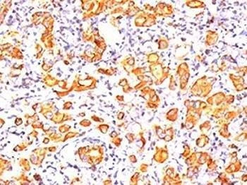 Anti-MUC1 Antibody Mucin-1, Sodium Azide Free