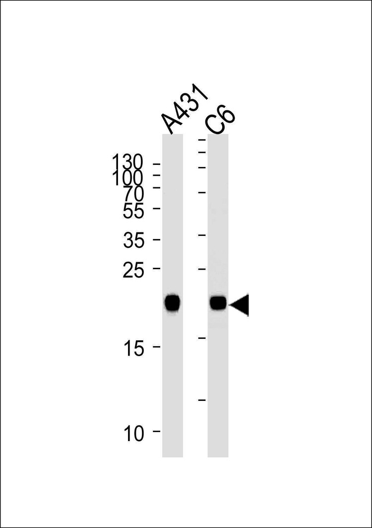 Anti-NRAS (N-term) Antibody