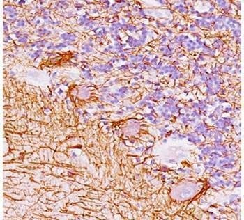 Anti-Neurofilament Antibody