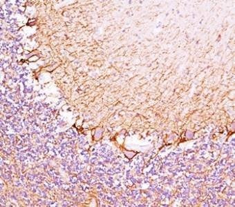 Anti-Neurofilament Heavy Antibody