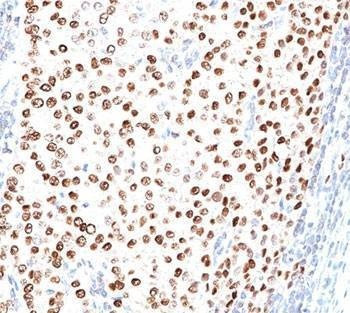 Anti-Progesterone Receptor Antibody, Sodium Azide Free