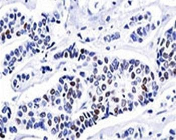 Anti-Progesterone Receptor Antibody, Sodium Azide Free