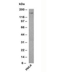 Anti-Podocalyxin Antibody