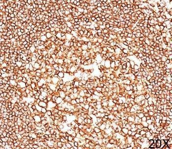 Anti-CD45 Antibody