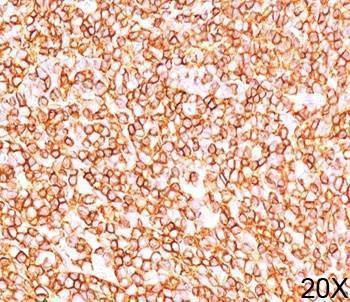 Anti-CD45RB Antibody