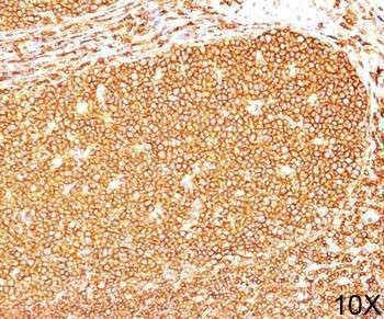 Anti-CD45RB Antibody