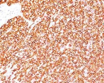 Anti-CD45RB Antibody, Sodium Azide Free