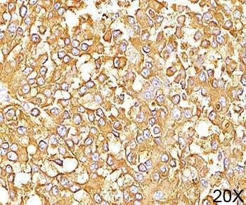 Anti-gp100 Antibody