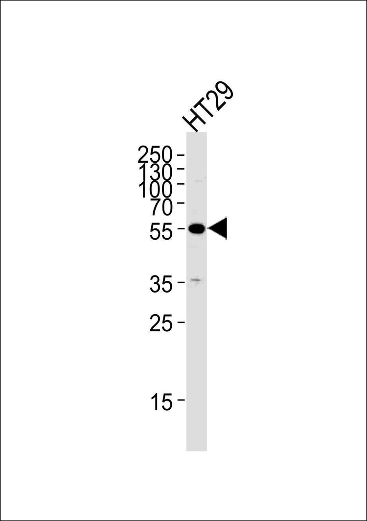 Anti-TP53 (N-term) Antibody
