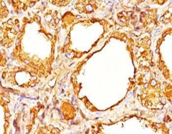 Anti-Thyroglobulin Antibody Cocktail
