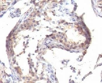Anti-TGF alpha Antibody, Sodium Azide Free