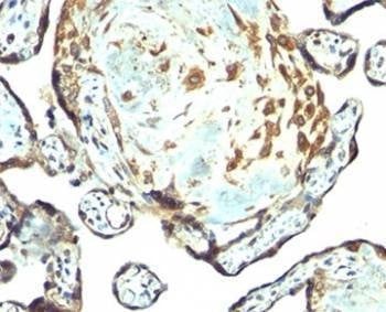 Anti-TIMP3 Antibody, Sodium Azide Free