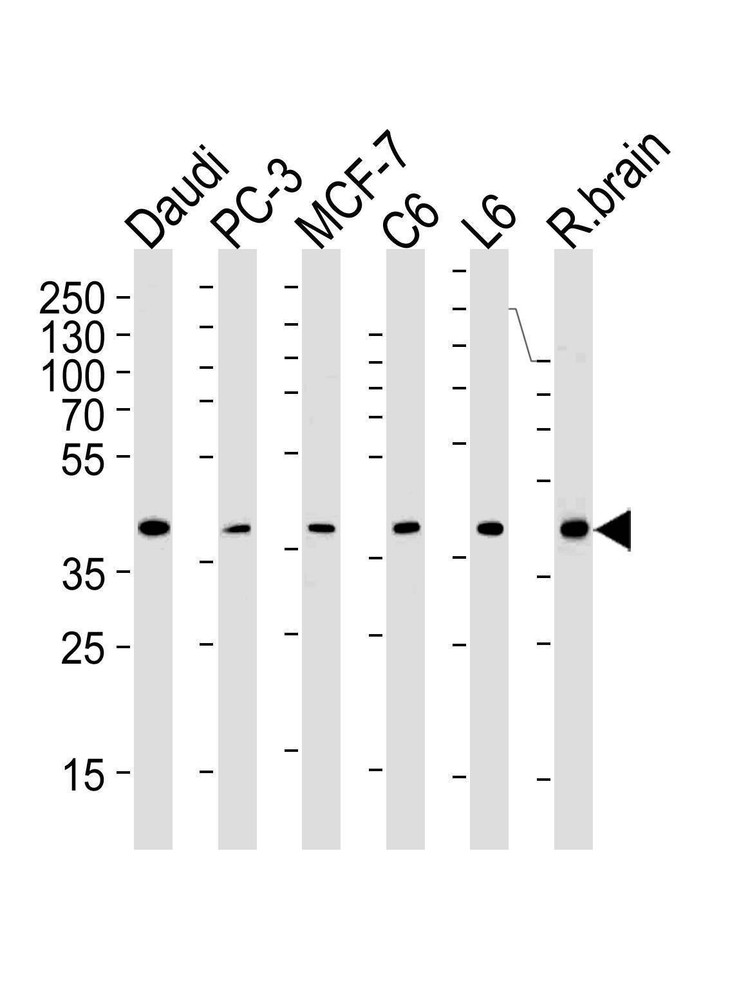 Anti-CREB3L4 (M01) Antibody