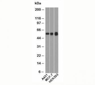 Anti-p53 Antibody N-terminus