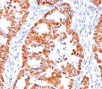 Anti-p53 Antibody N-terminus