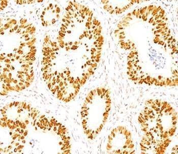 Anti-p53 Antibody, Sodium Azide Free