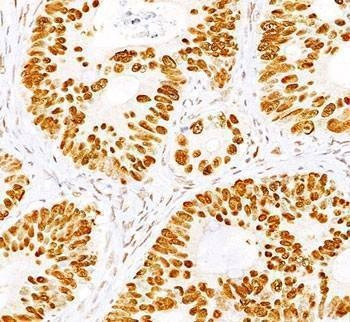 Anti-p53 Antibody Cocktail