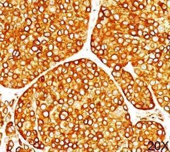 Anti-Tyrosinase Antibody, Sodium Azide Free