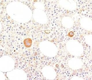 Anti-von Willebrand Factor Antibody, Sodium Azide Free
