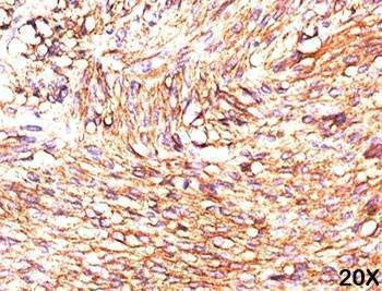 Anti-TMEM16A Antibody (DOG1), Sodium Azide Free