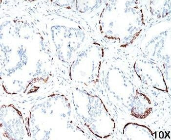 Anti-HMW Cytokeratin Antibody