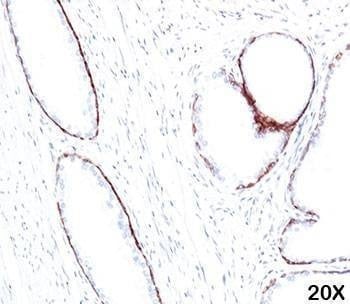 Anti-HMW Cytokeratin Antibody, Sodium Azide Free