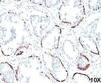 Anti-HMW Cytokeratin Antibody, Sodium Azide Free