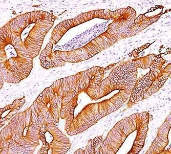 Anti-Pan Cytokeratin Antibody Cocktail