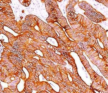 Anti-Pan Cytokeratin Antibody Cocktail, Sodium Azide Free