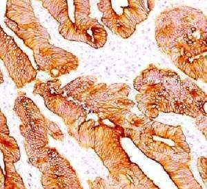 Anti-Multi Cytokeratin Antibody 4/5/6/8/10/13/18