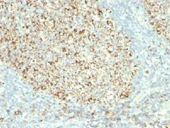 Anti-Mitochondria Antibody, Sodium Azide Free