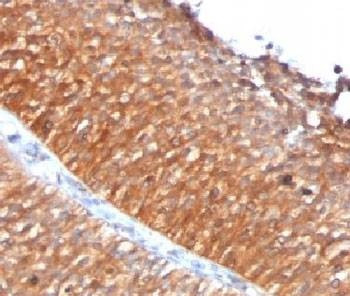 Anti-Mitochondrial Antibody, Sodium Azide Free
