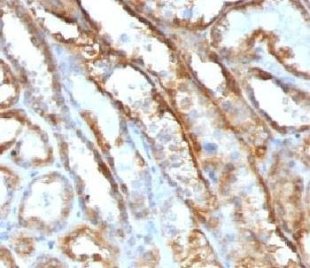 Anti-Mitochondrial Antibody, Sodium Azide Free