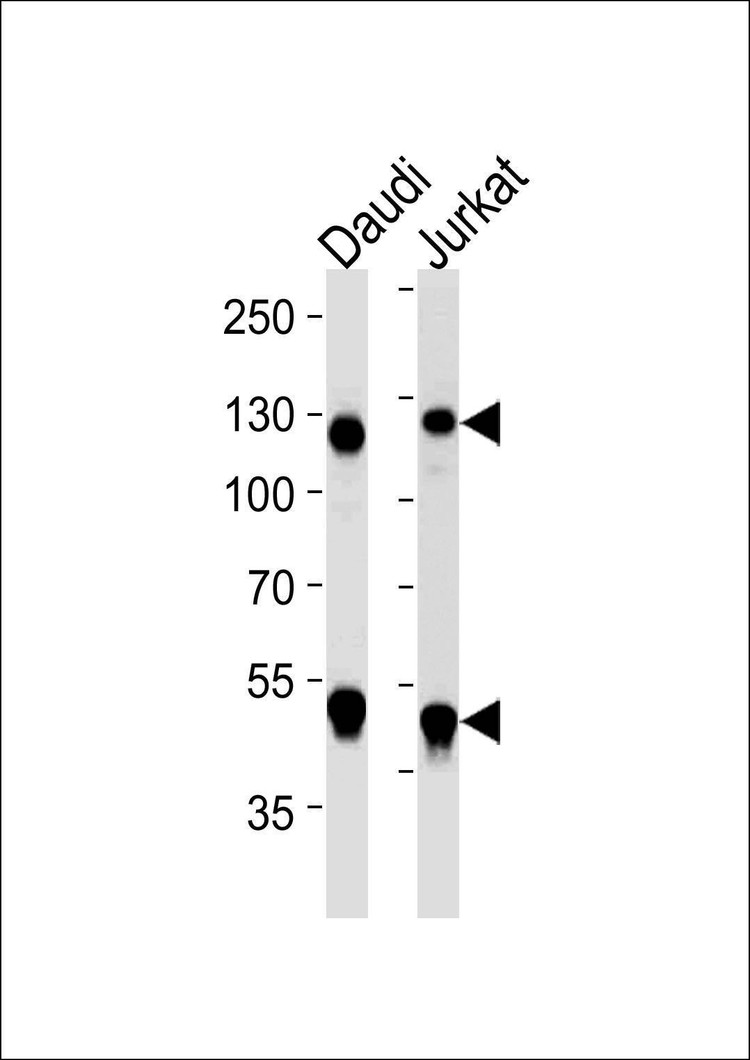 Anti-NFKB1 Antibody