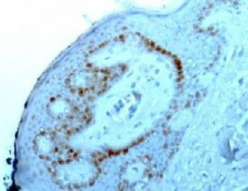 Anti-Nucleoli Marker Antibody