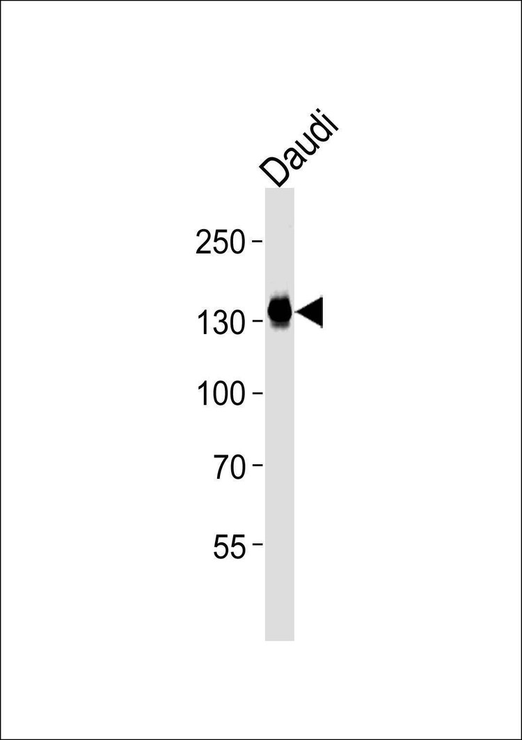 Anti-USP25 Antibody