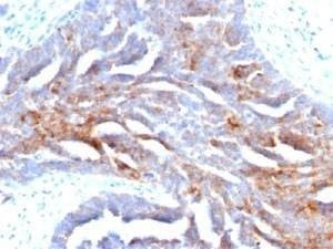 Anti-TAG-72 Antibody, Sodium Azide Free