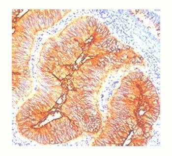Anti-TAG-72 Antibody, Sodium Azide Free