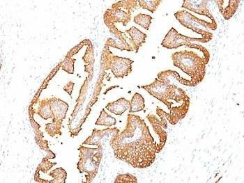 Anti-PSA Antibody