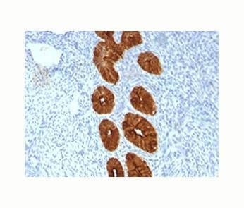 Anti-Epithelial Marker Antigen Antibody, Sodium Azide Free