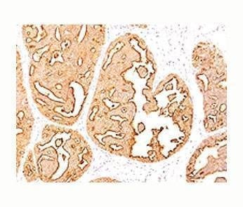 Anti-Epithelial Marker Antigen Antibody, Sodium Azide Free