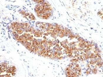 Anti-EMA Antibody