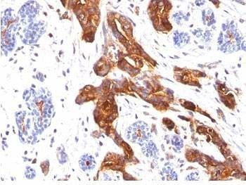 Anti-EMA Antibody