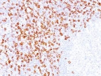 Anti-CD8 Antibody