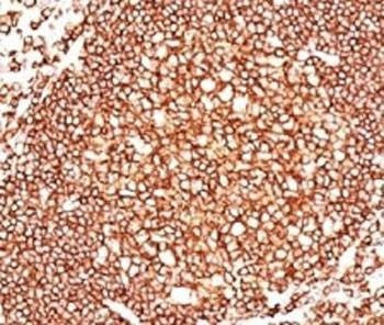 Anti-CD45 Antibody