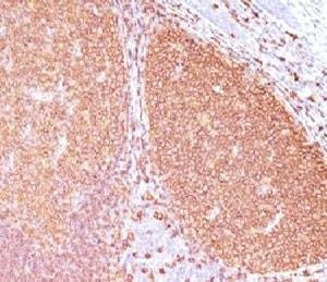 Anti-CD20 Antibody