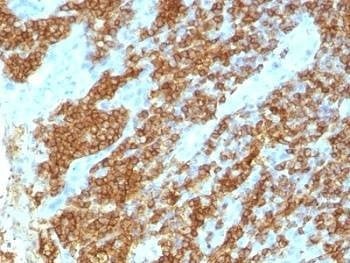 Anti-CD45RA Antibody