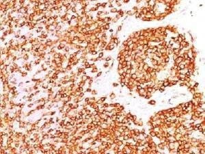 Anti-CD45RB Antibody, Sodium Azide Free